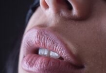 “자꾸 입술이 찢어지고 갈라져요”… 단순 건조 아닌 만성 염증 신호일 수도 person with red lipstick and black mascara